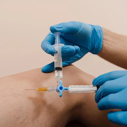 dr-marco-munia-medicina-vascular-atendimentos-escleroterapia