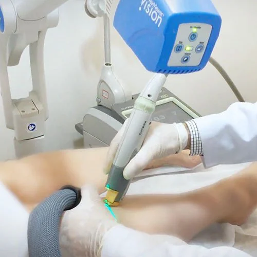 dr-marco-munia-medicina-vascular-atendimentos-laser-em-varizes